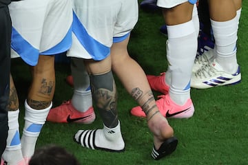 Lionel Messi ankle was visibly swollen after he trudged from the field in Miami last Sunday.